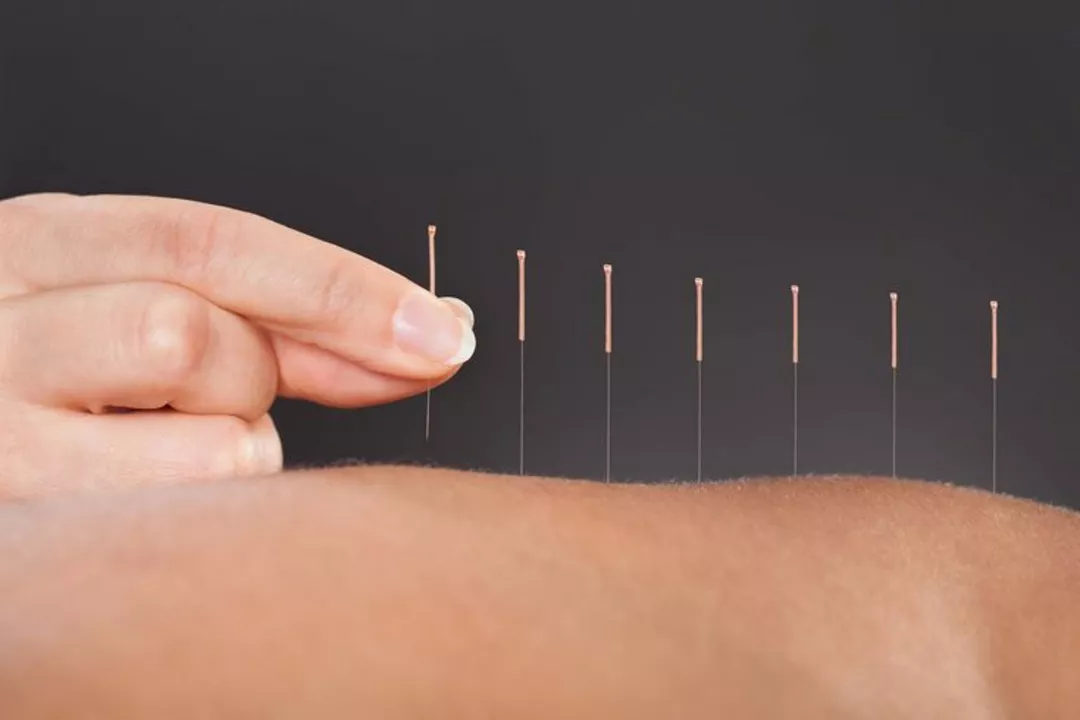 The Benefits of Acupuncture for Ovulation and Fertility